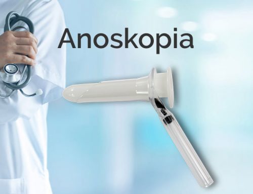 Anoskopia – opis badania za pomocą anoskopu