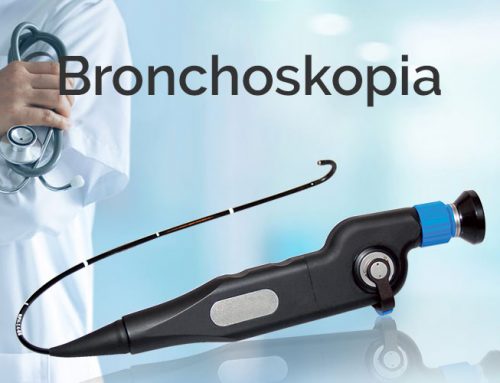 Bronchoskopia