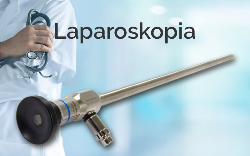 Laparoskopia